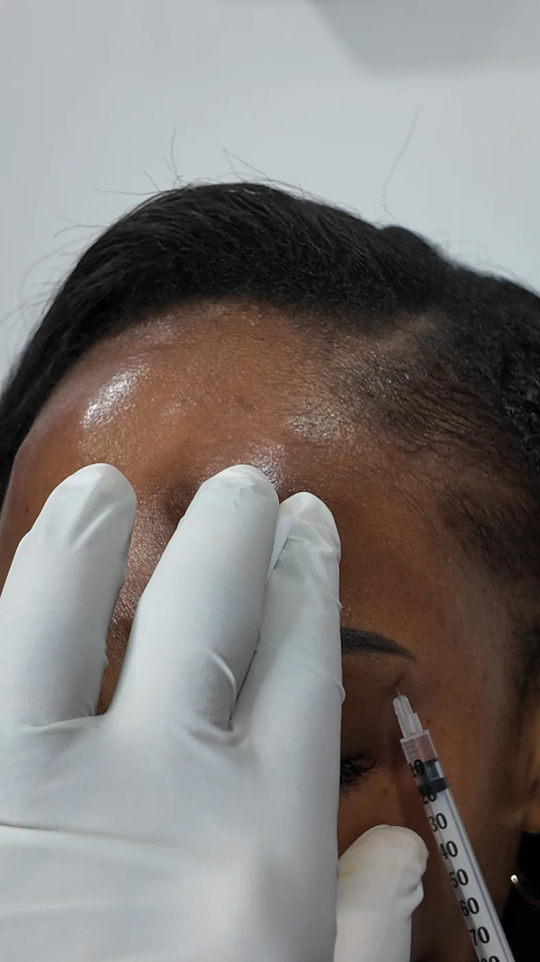 Botox&reg; offer at Refine Clinic