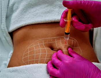 Body Contouring