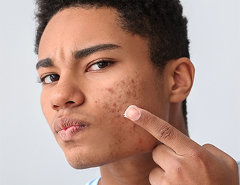 Inflammatory Skin