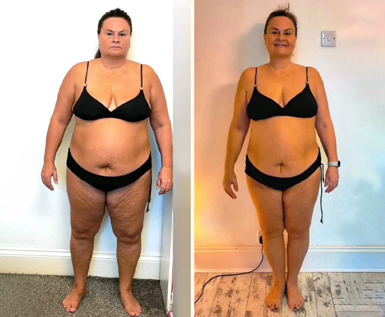 Patient Dot Weight Loss Transformation