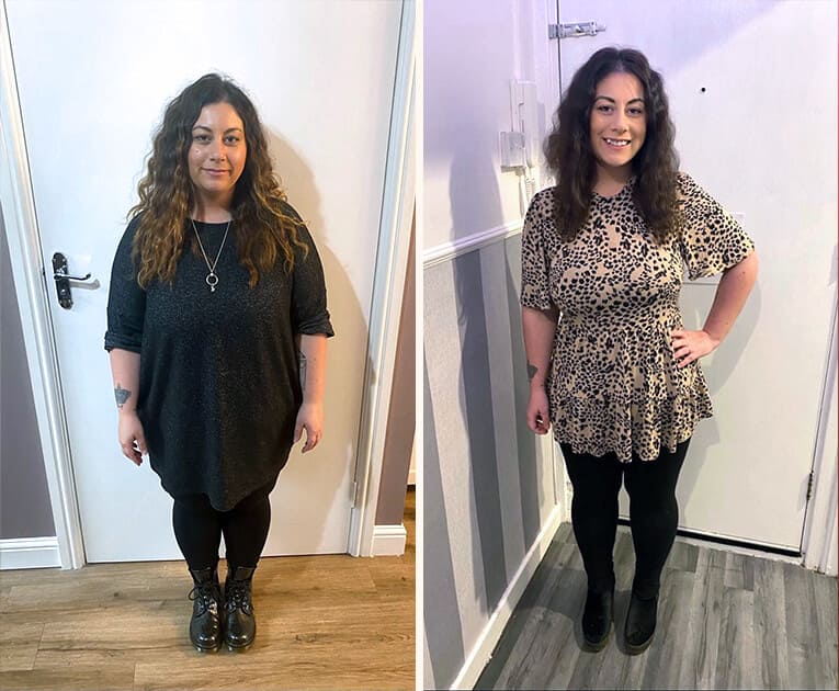 Patient Georgie Weight Loss Transformation
