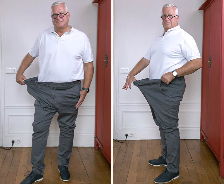 Patient Jacques Weight Loss Transformation