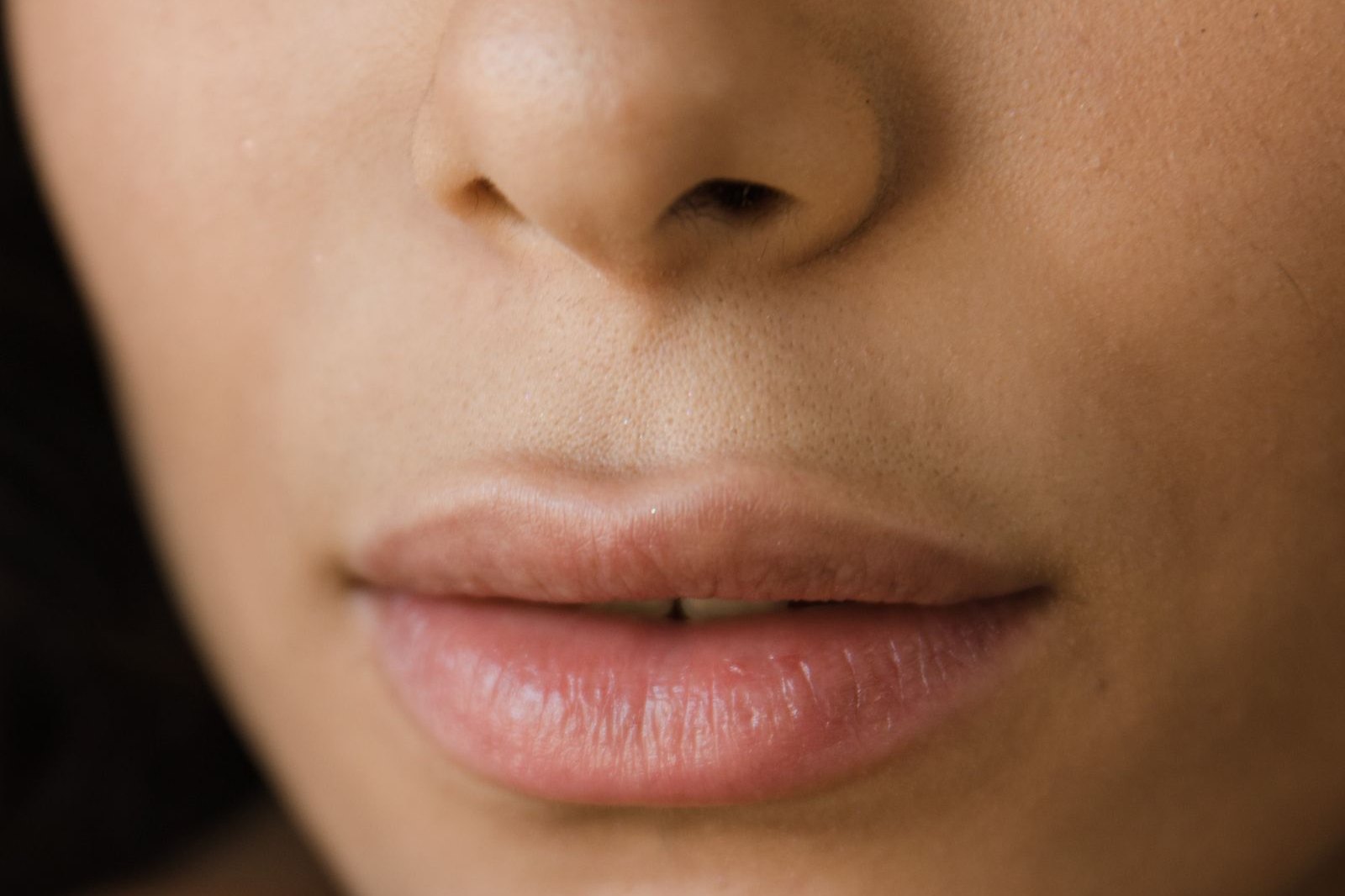 How Long Does Lip Filler Swelling Last?
