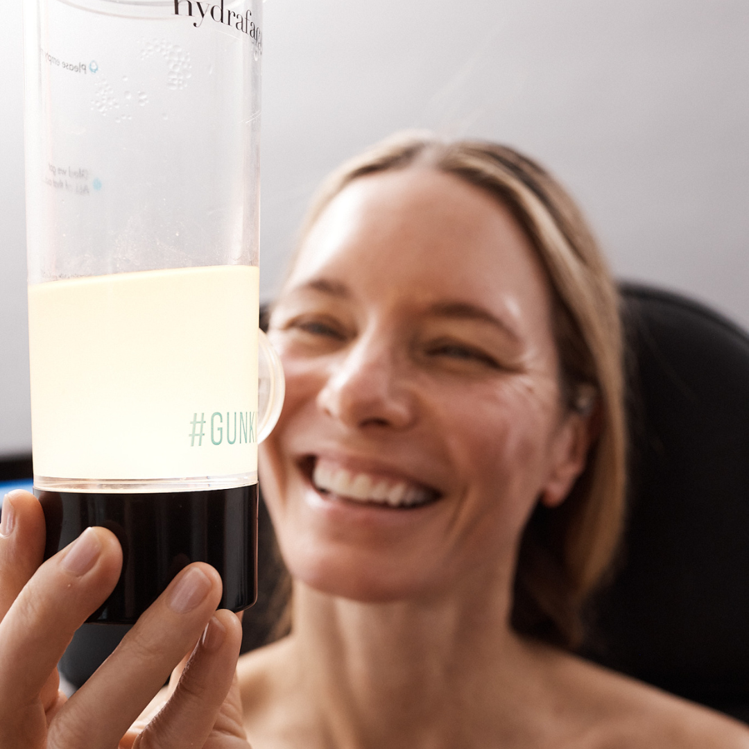Patient Inspecting Extracted Impurities in HydraFacial Gunkie Canister