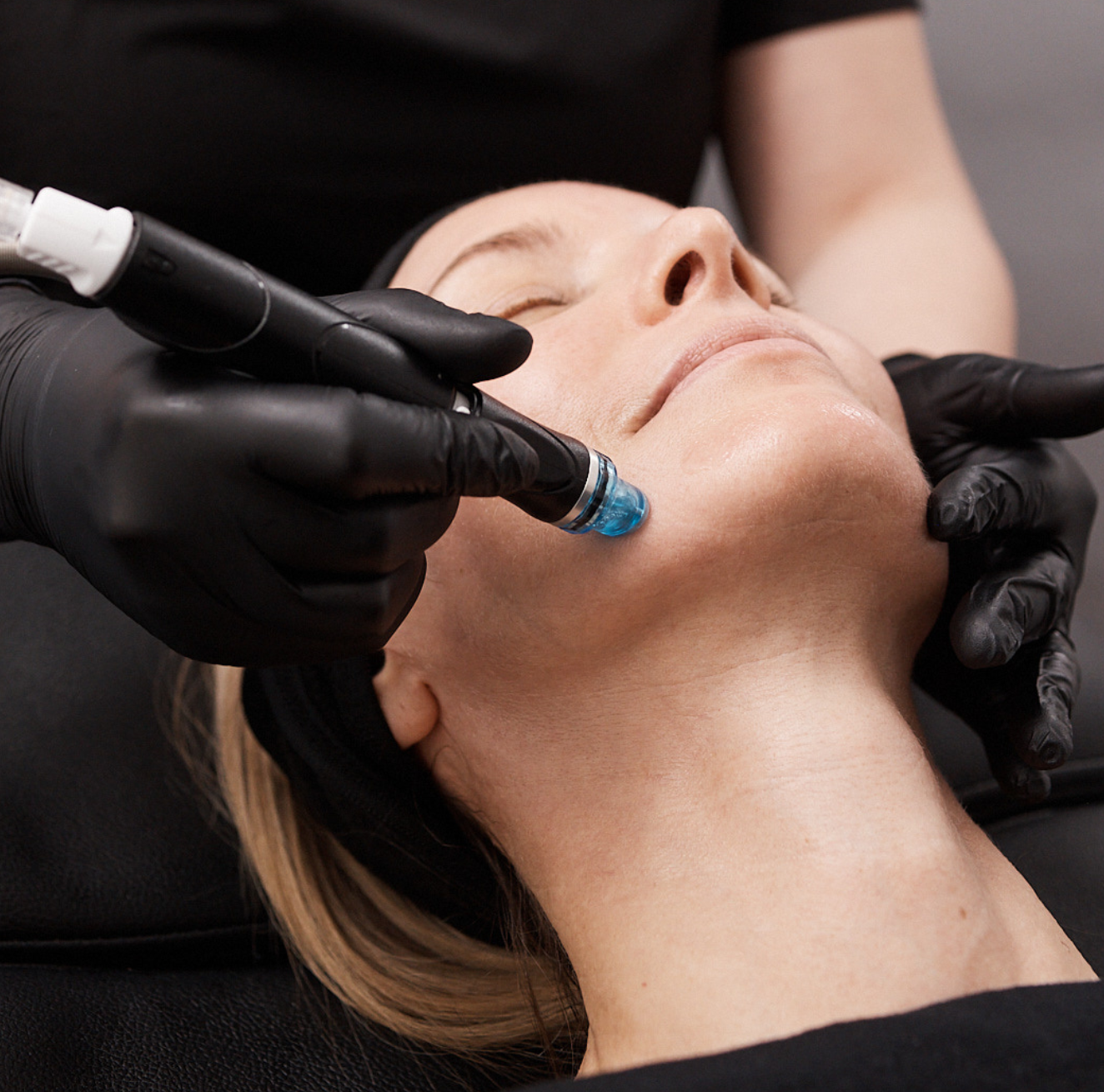 Step 2: Cleanse and Exfoliate with Activ-4 Serum