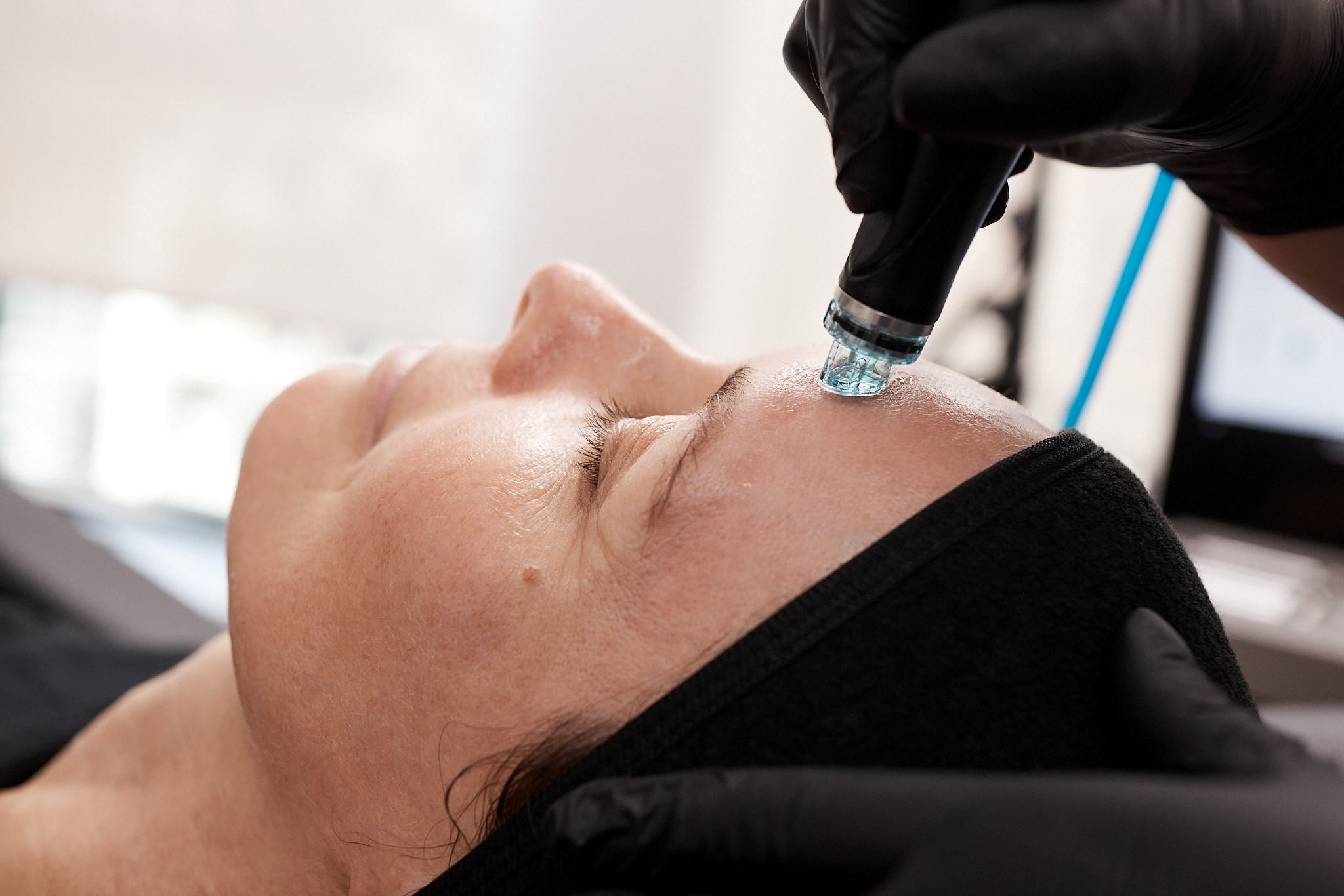 Step 4: Vortex-Fusion Extractions with Beta-HD Serum
