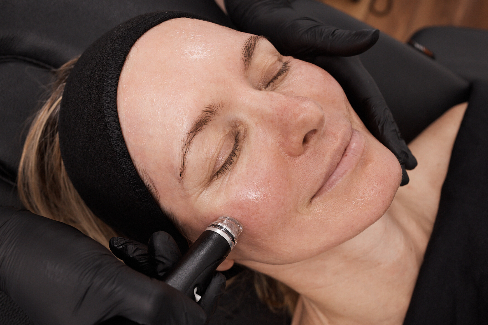 Step 7: Vortex-Fusion Hydration and Dermal Protection