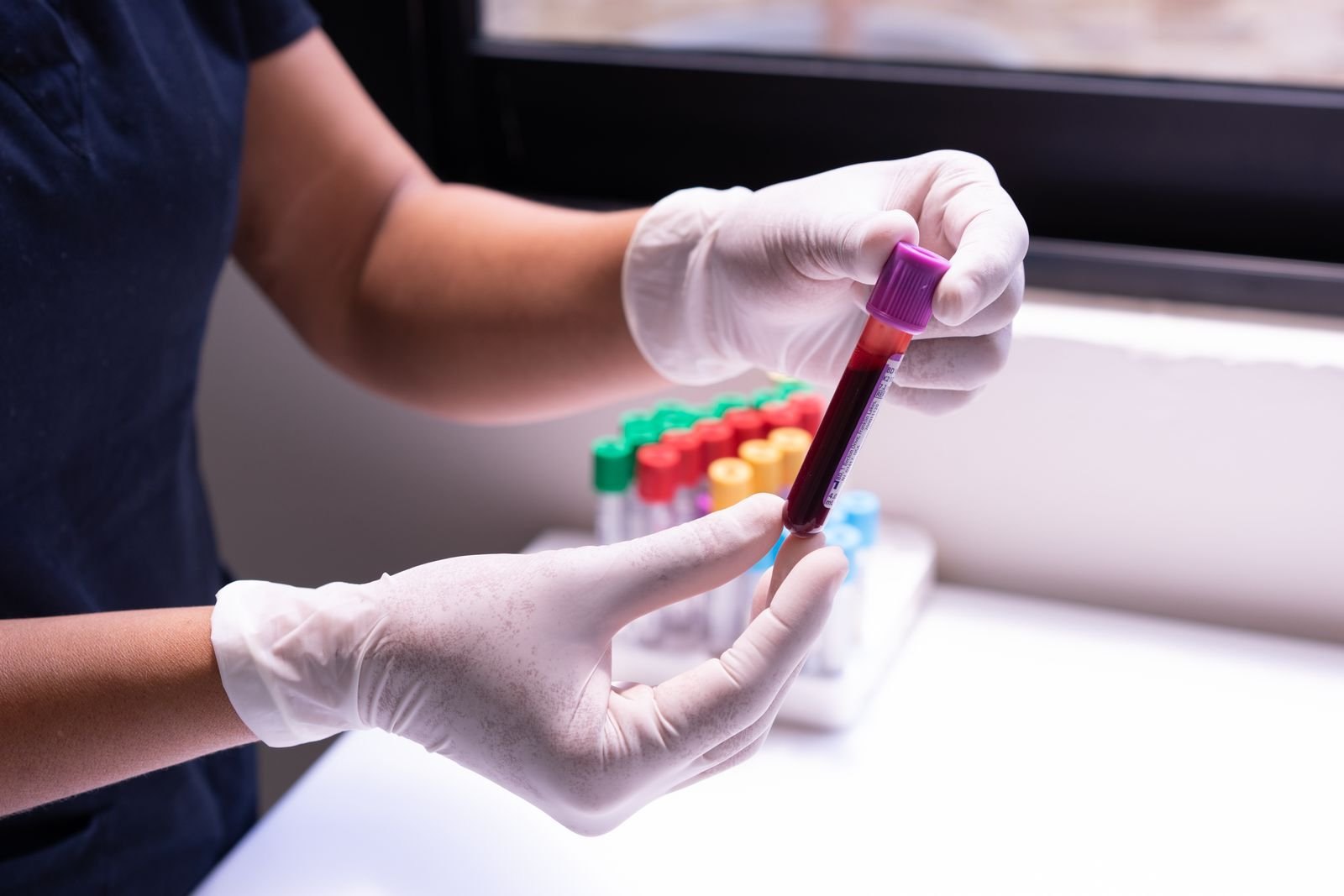 Gloved clinician holding a blood-sample tube in a clinic laboratory