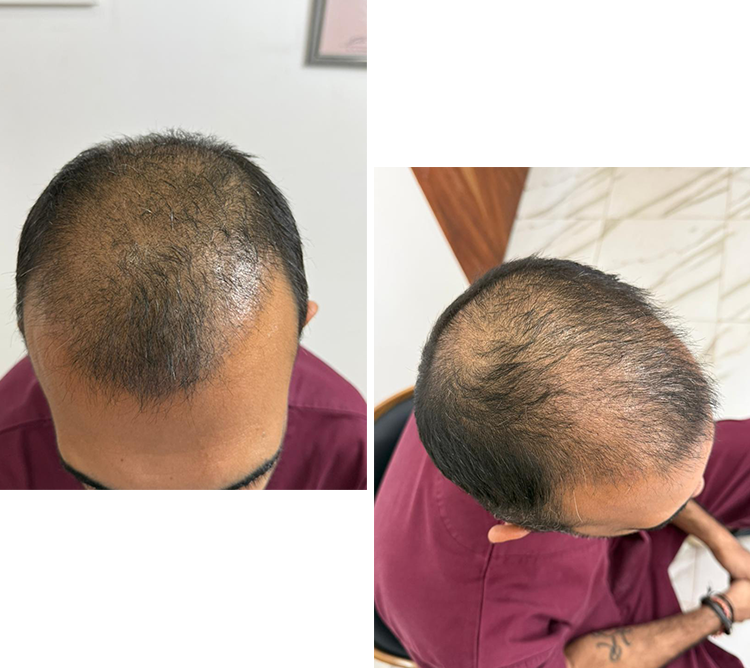 Wonder Axon Treatment.