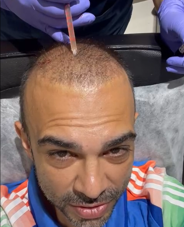 Hair Treatment