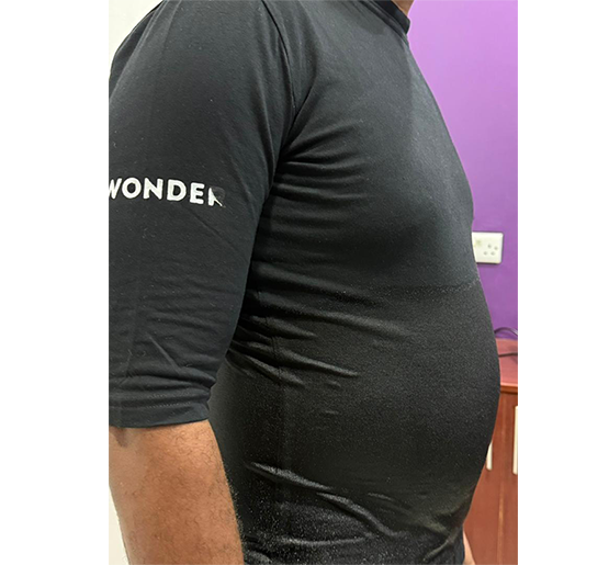 Wonder Axon Treatment.